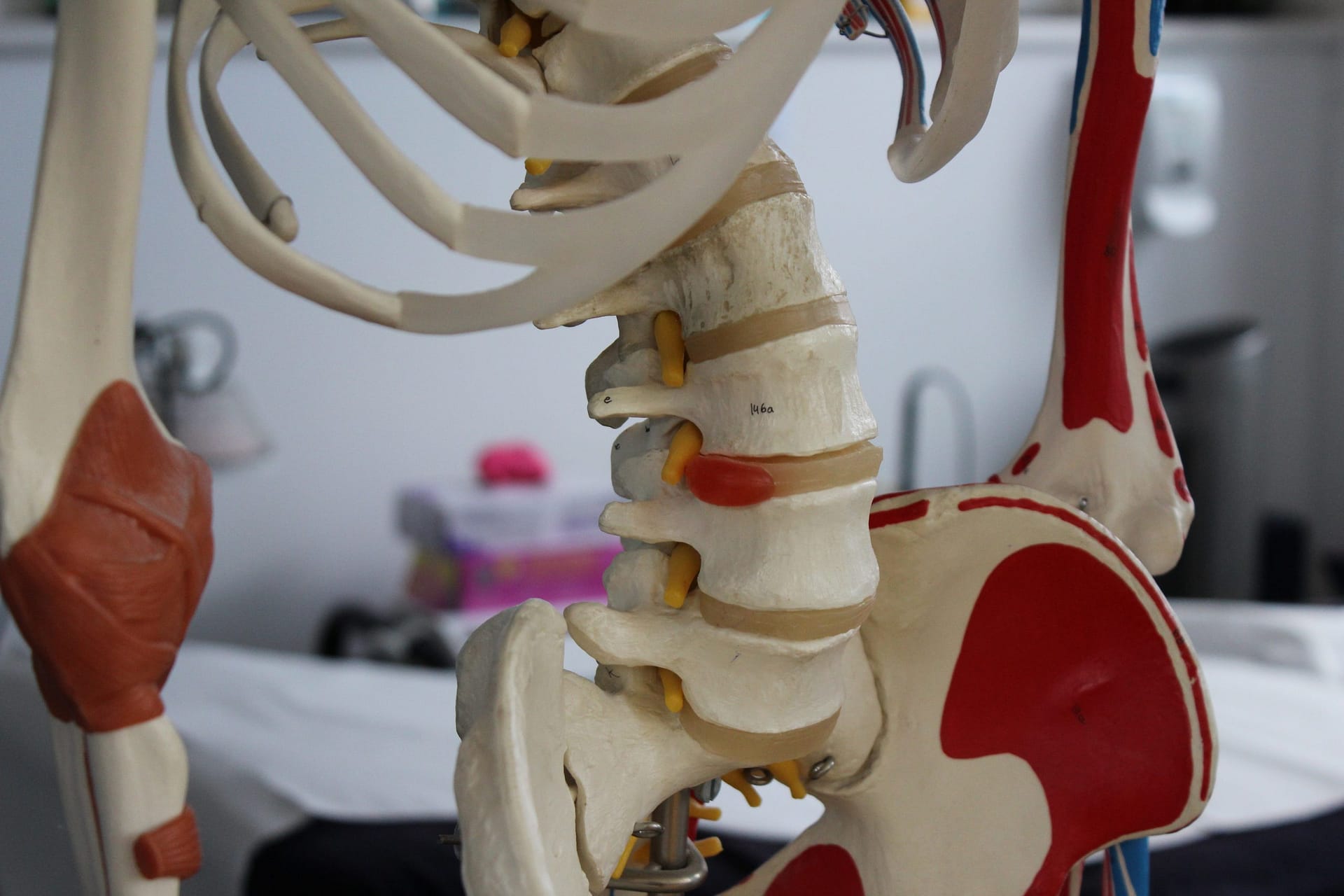 Bulging Prolapsed Disc | Sciatica | Leg Pain Osteolates Applied Pilates St Albans