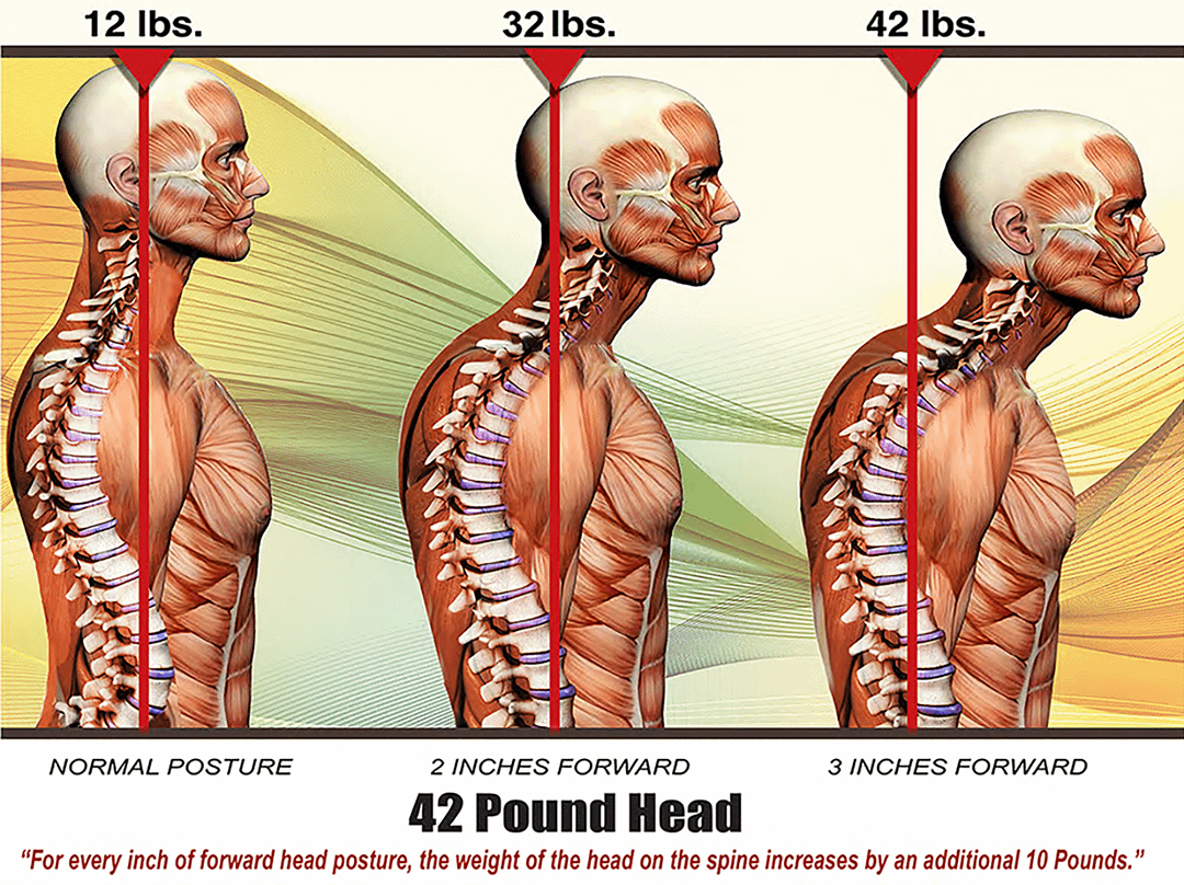 Posture correction at The Sogunro Practice, London Colney, St Albans — Applied Pilates and Osteolates Therapy to retrain deep stabilising muscles for lasting postural improvement.